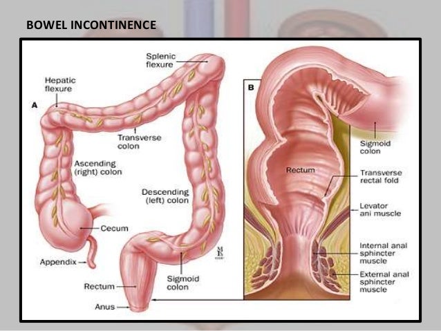 fecal incontinence anal sex Gentile lesbian vids